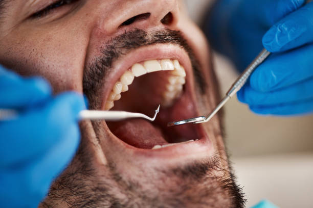 Emergency Dentist Open Today in CA