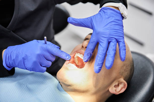 Best Urgent Tooth Repair  in Clearlake, CA