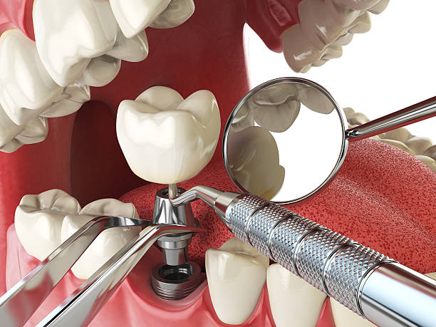 Best Emergency Tooth Extraction  in Clearlake, CA